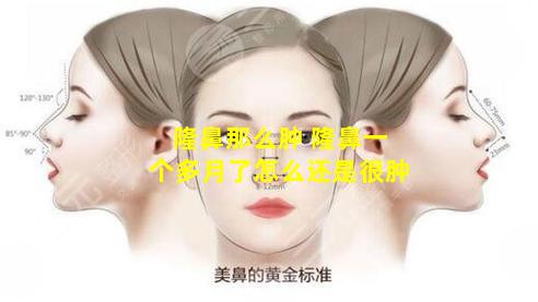 隆鼻那么肿 隆鼻一个多月了怎么还是很肿